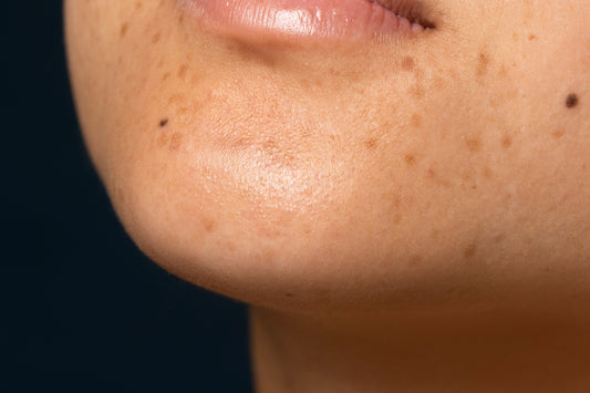 Fade Pigmentation Naturally: The Secret Power of Edible Ceramides