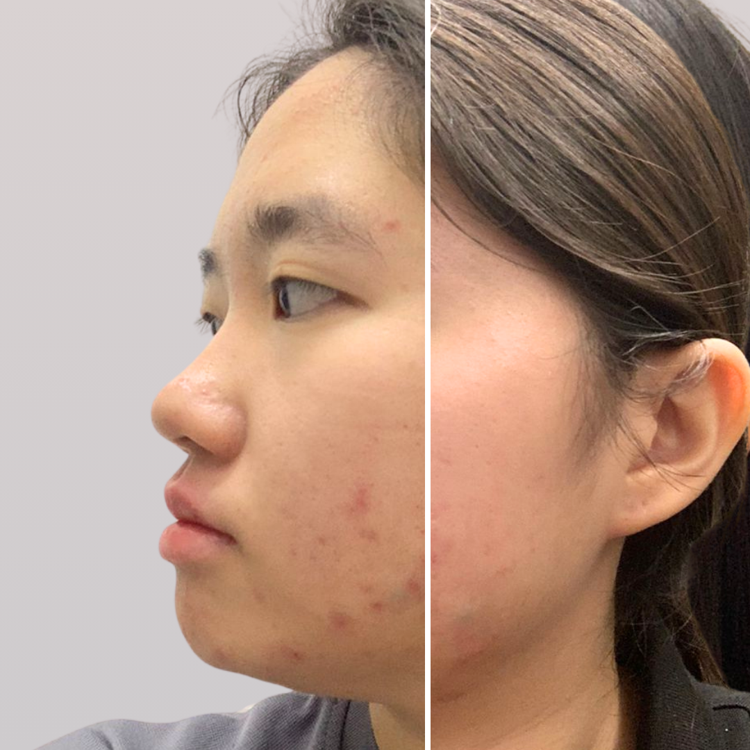 dorothy before after consume cerayouth